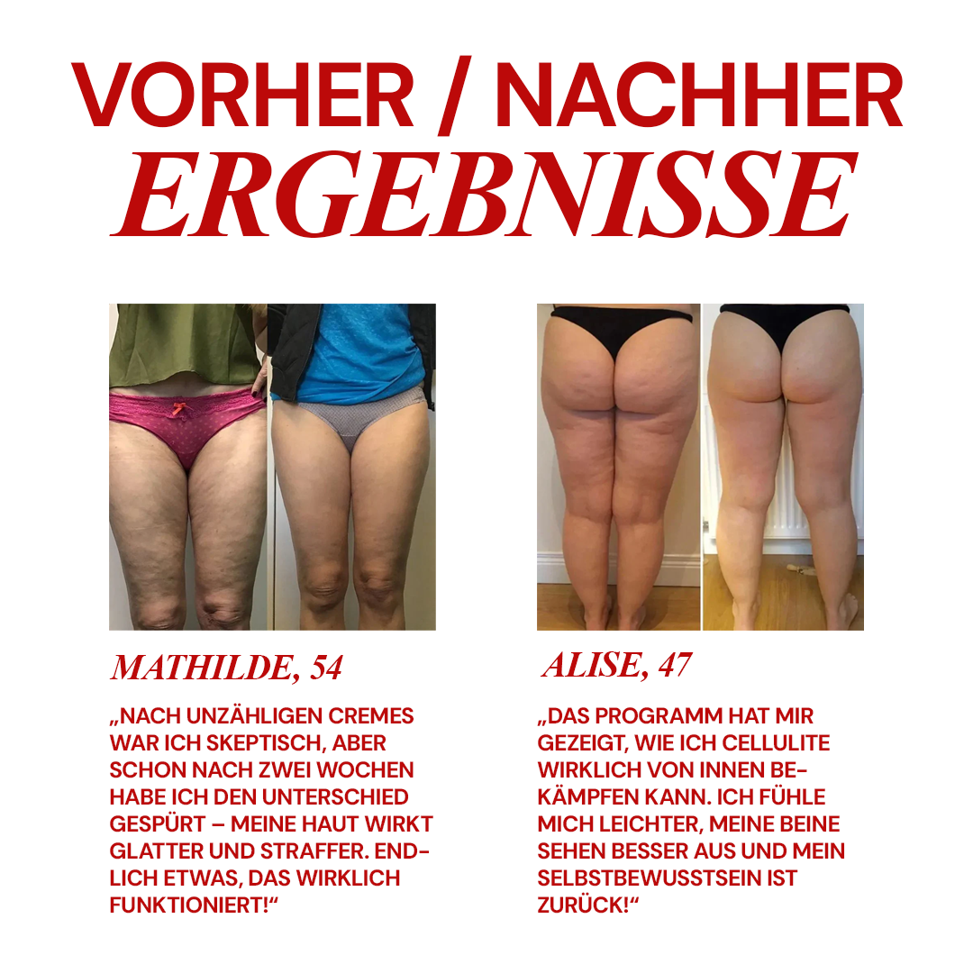 Nie wieder Cellulite (CelluFree™ PDF-Download)